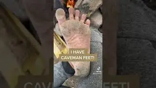 I have caveman feet!
