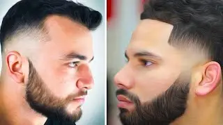 The Secret To GREAT Hairlines Revealed [Hair Transplant Tips]
