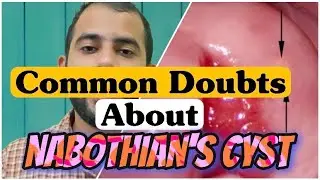 Nabothian’s Cyst Can Also Leads To Infertility|Clearing Your Doubts About Cervical Cysts