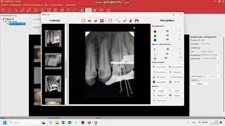 Обучение работе с программным обеспечением HandyDentist