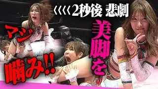 Shocking! She bit it! The relentless biting of a beautiful thigh! Watch SKE member Yuki Arai's fi...