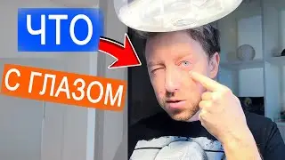 ВЛОГ: У Димки болит глаз |  1.12.20