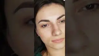 Брови зажившие  20181010 122646