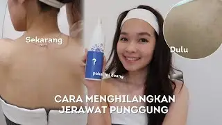 Rutin Pakai Produk Ini Jerawat Punggung AUTO Hilang🤩 | Review Erha AcneAct