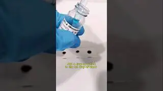 blood typing procedure 