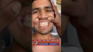 Teeth medical test || army medical test 