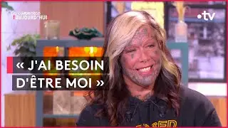Tatouage : "on ne peut pas être tout le temps comme les gens souhaitent qu'on soit" - CCA