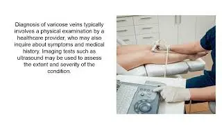 Varicose Veins: Facts and Prevention