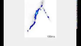 Calcium Measurements Using Crest Spinning Disk Confocal | Cairn Research Ltd