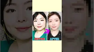 This will give you ✨DEFINED JAWLINE✨(No Makeup, No Invasive Surgery, No Tools!)