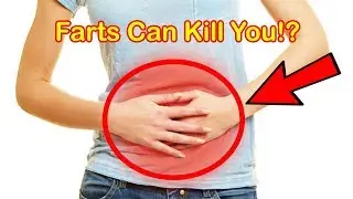 How Holding In a Fart Can KILL You