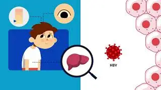 Herstellung eines Impfstoffes am Beispiel der Hepatitis B-Impfung