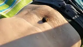 Caught a hermit crab in my belly button