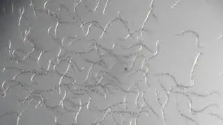 Grupo Iñesta - Nematodos J2 del género Meloidogyne sp activos