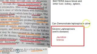Microbiology 370 b LeptoSpirosis Weils Disease Pathogenesis