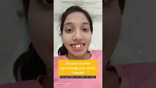 Transform your Smile with CAD CAM Zirconia crowns; Dr. Srishti Bhatia 