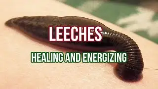HIRUDOTHERAPY: USEFUL PROPERTIES OF LEECHES