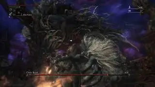 Bloodborne™: Cleric Beast vs. Beasthunter Saif