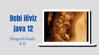 Embrion java 12  Ekografi 4D (12 weeks embryo in 4D ultrasound)