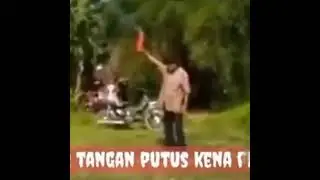 BUNTUNG NYAH TANGAN BAPA INIH KENA PETASAN DAH MENG GEGERKAN PARA WARGA😭😭😭😭
