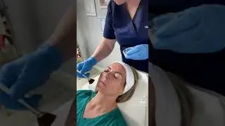Superficial chemical peels