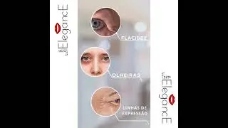 Cópia de Cópia de Cópia de Cópia de Cópia de Cópia de Cópia de preenchimento facial   feminino
