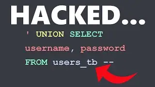 Why HACKERS Love SQL Injections