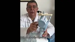 REDUCCIÓN DE LA MANZANA DE ADÁN/ TRACHEAL SHAVE