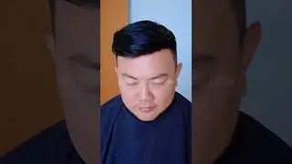 Before dan After setelah memasang toupee dibagian depan