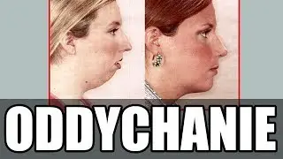 Wpływ oddychania przez usta na rozwój twarzy