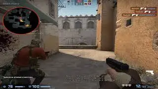 Contest (FACEIT/Retake Highlights)