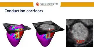 Cardiac MRI and Electro Pathology: Current Status and Future Perspectives
