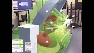 iPadAR Angiograpy 1