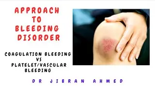 APPROACH TO BLEEDING DISORDER II PLATELET/VASCULAR VS COAGULATION DISORDER BLEEDING II