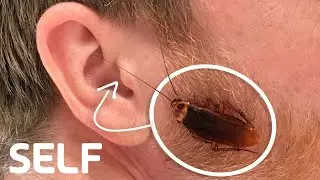 Can a Cockroach Get Stuck in Your Ear? | How Common Is It? | SELF