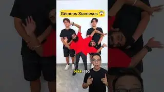Gêmeos Siameses 😱 