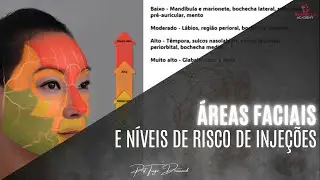 Áreas faciais e níveis de risco de injeção