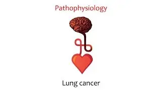 Lung Cancer