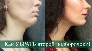Как УБРАТЬ Второй подбородок! БЫСТРЫЙ и ЭФФЕКТИВНЫЙ способ!!!