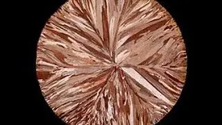Is Copper Behind the Alzheimer's Epidemic?