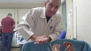 Orientação no uso de fixador externo ilizarov para a marcha @antonioeuclidesvitalneto2802