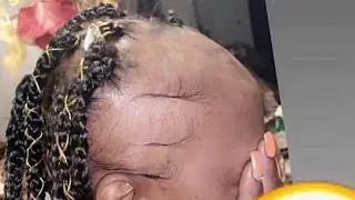 😱 Don’t Do THis To Your Edges