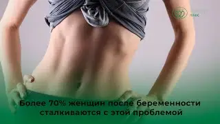 Диастаз - причины возникновения, лечение