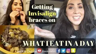 Getting Invisalign braces on | What I eat in a day