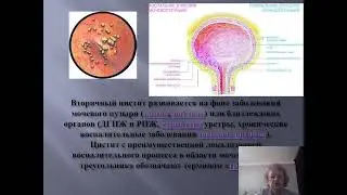 Simchenko N.I. Nonspecific inflammatory diseases of the genitourinary system