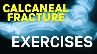 Calcaneal Fracture Exercises