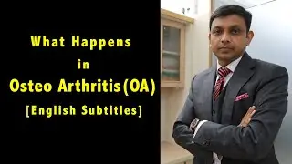 What Happens in Osteoarthritis OA