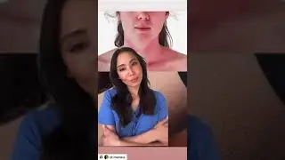 First Aid Beauty Ultra Repair Cream | Dr. Mamina, Board-Certified Dermatologist
