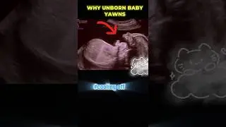 The real reason why your baby yawns in womb#ultrasound  #shorts #babyboy #baby