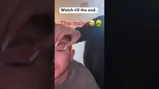 OMG 🥵